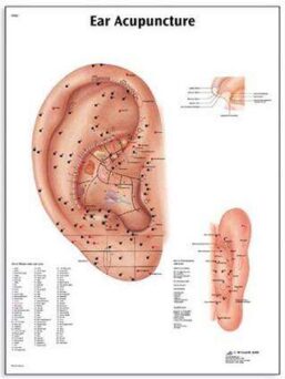 Plansa ACUPUNCTURA URECHII